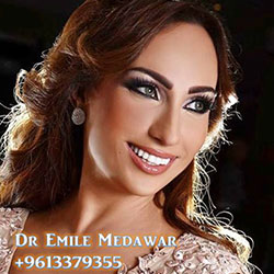 Composite Veneers Lebanon