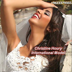 Composite Veneers Lebanon